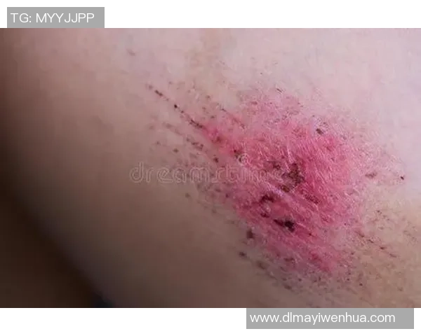 足球意外碰撞背部的趣事与启示，运动中的小意外如何影响比赛表现